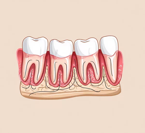Root Canal Treatment - What is it