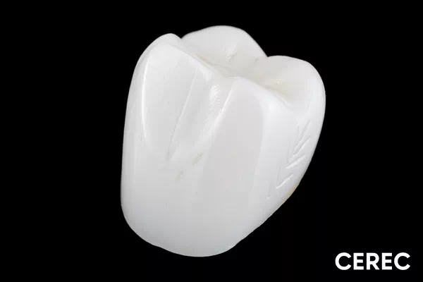 Dental Crowns