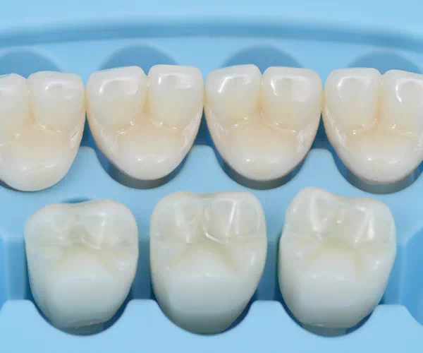What are dental crowns
