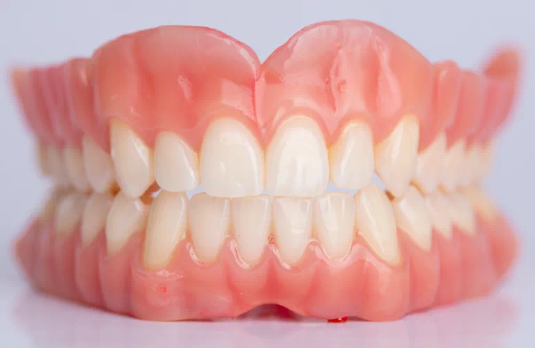 Dentures are removable or non-removable substitutes for missing teeth and gums