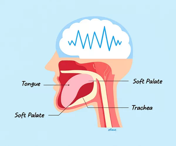 What is sleep apnea