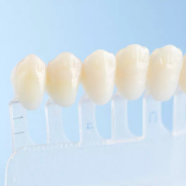 What are veneers
