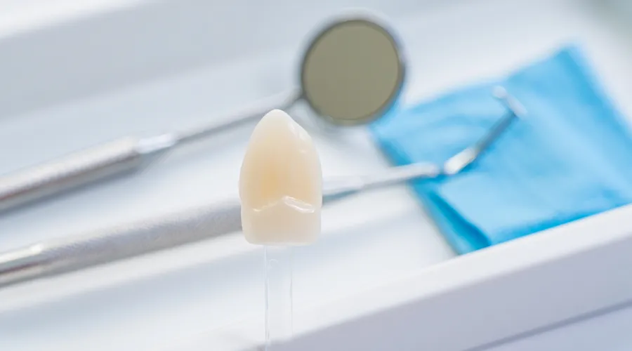 How much does Porcelain Veneers cost